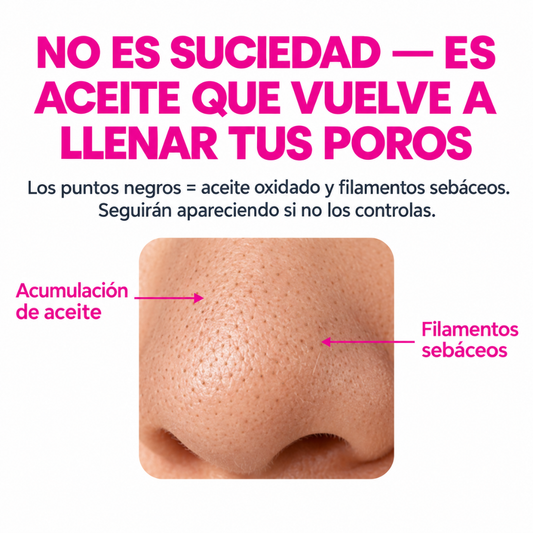 PoreLift™ Removedor de poros facial