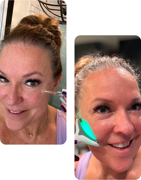 Paso 2: Presione contra la piel