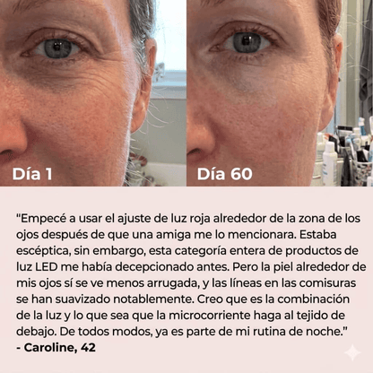 ✨Escultor facial LED 7 en 1 Lumine | Terapia Relajante de Luz led en Casa + Serum EXTRA De Regalo💧💆‍♀️
