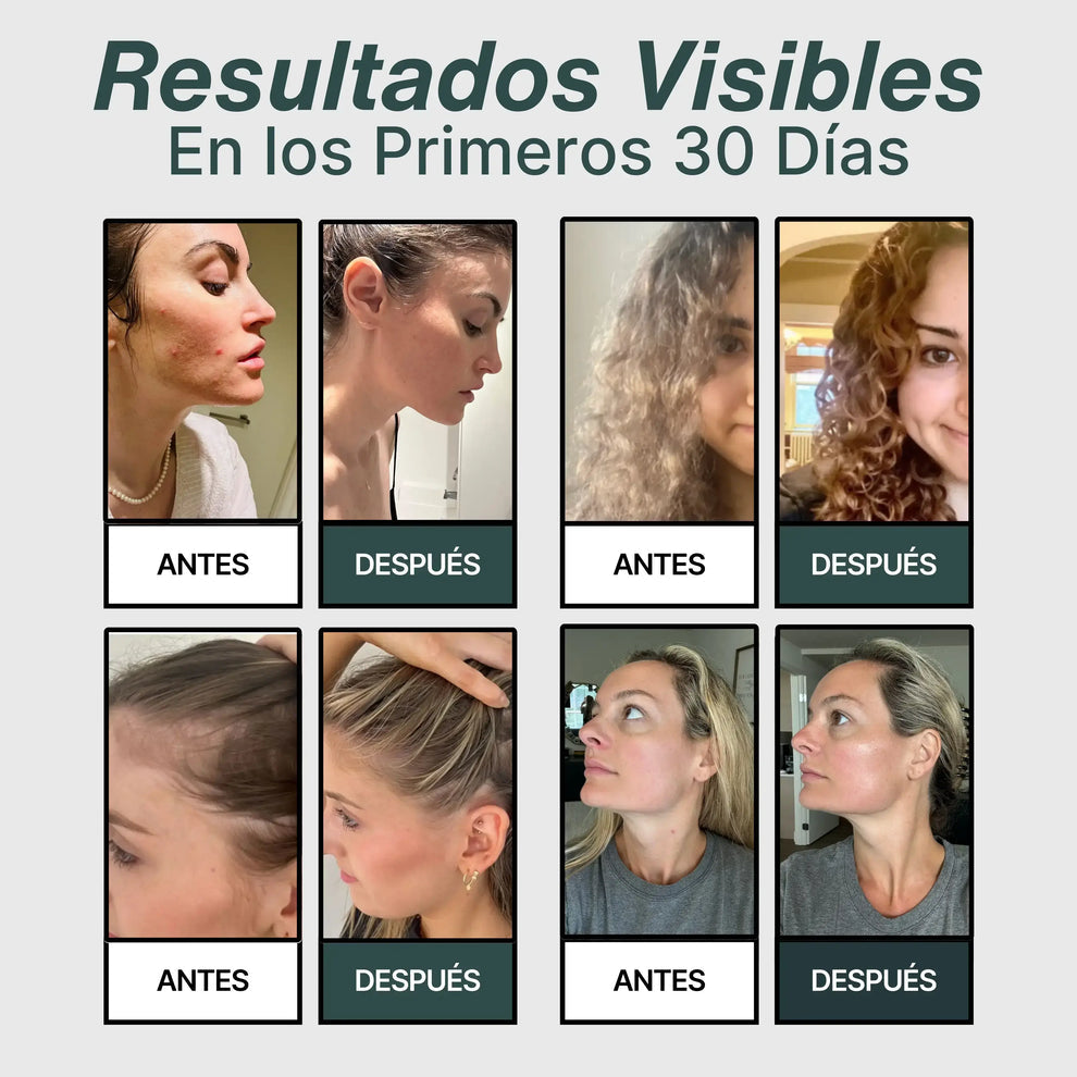 Salva Tu Piel, Tu Pelo y Tu Salud del Desastre con Lumine™