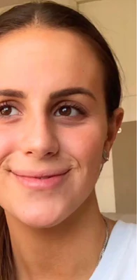 Before - 86% Piel visiblemente más tensa y clara