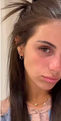 After - 86% Piel visiblemente más tensa y clara