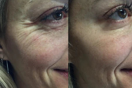 ¿Por qué se forman las arrugas?