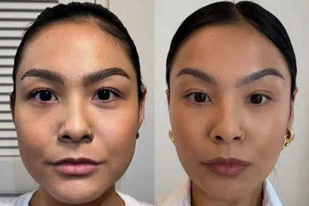 ¿Por qué se produce la hinchazón facial?