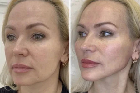 ¿Por qué se cae la piel?