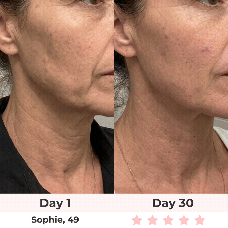 ✨Escultor facial LED 7 en 1 Lumine | Terapia Relajante de Luz led en Casa + Serum EXTRA De Regalo💧💆‍♀️